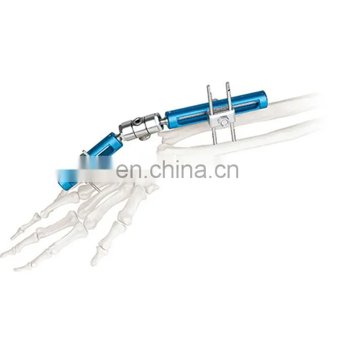 High Quality Wrist Joint External Fixator Orthopedic Surgical Instrument