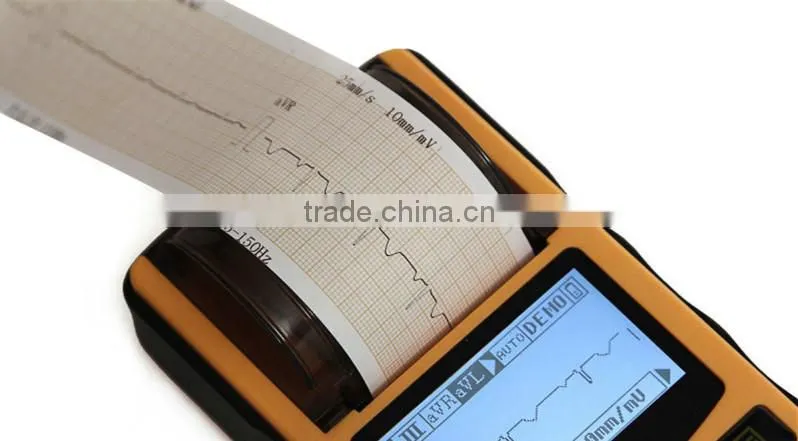 Digital 1-channel Handheld Electrocardiograph