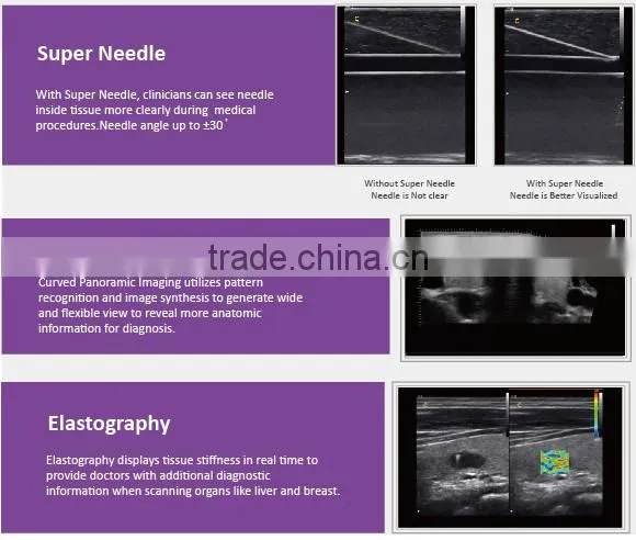 CE approved Portable Color Ultrasound Scanner with Optional 4D function( Q9)