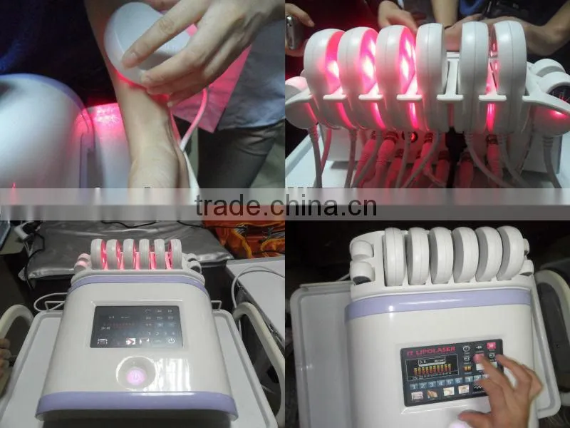 No-invasive I- Laser System For Fat Removal