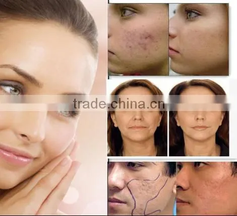 The Portable PDT Facial Beauty Machine for skin rejuvenation and regrowing collagen