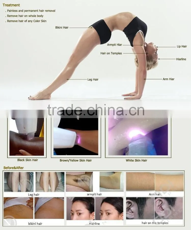 TEC +Sapphire cool laser facial rejuvenation and hair removal machine