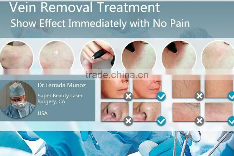 2015 Portable Permanent Freckle Removal Machine