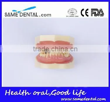 Dental Moderate Periodontal Disease Model Teaching Demonstration