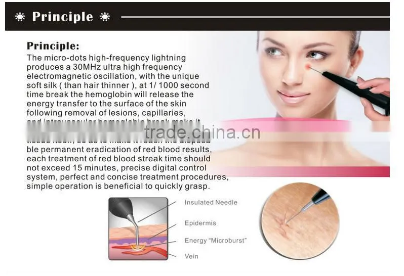 RBS vascular removal spider vein treatment spider vein removal beauty machine--RBS100 PROMOTION PRICE