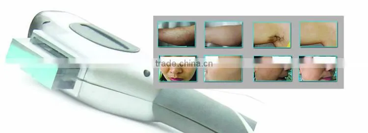 2016 new shape!!! ipl laser permanent facial hair removal for women for beauty salon