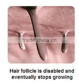 2016 Newest IPL Hair Removal Machine Prices / factory price ipl hand elight