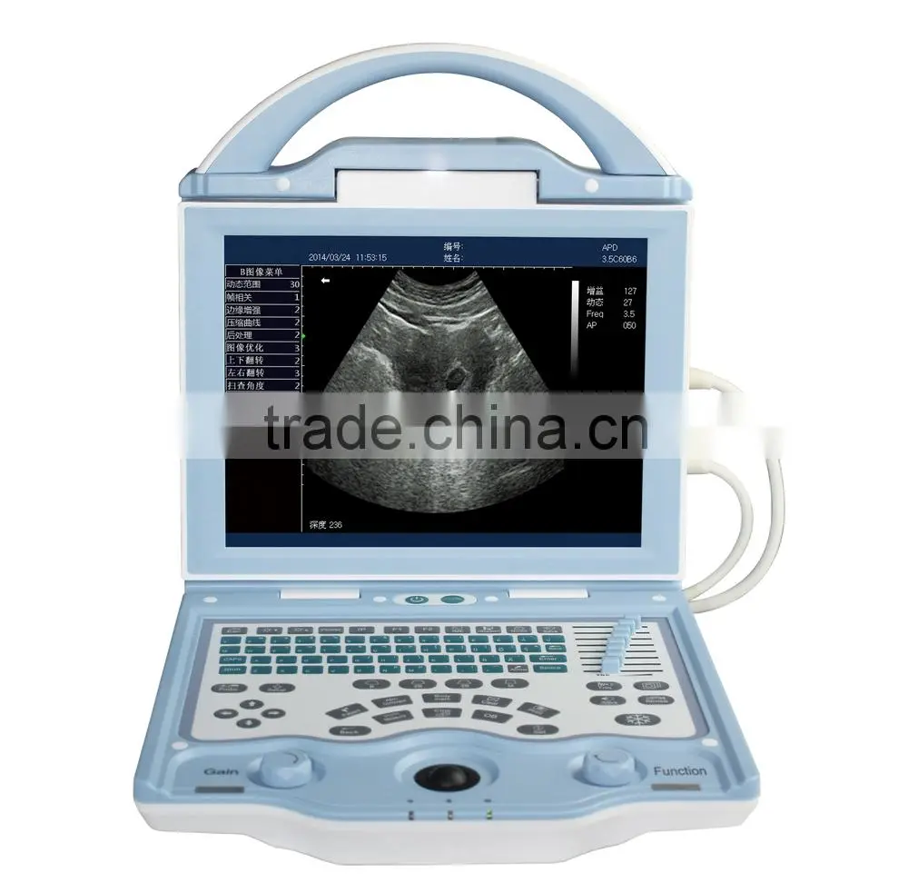 FN560V portable vet ultrasound device