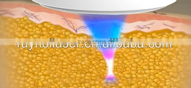 Raynol Laser Multi-Function Liposonix Cavitation Machine