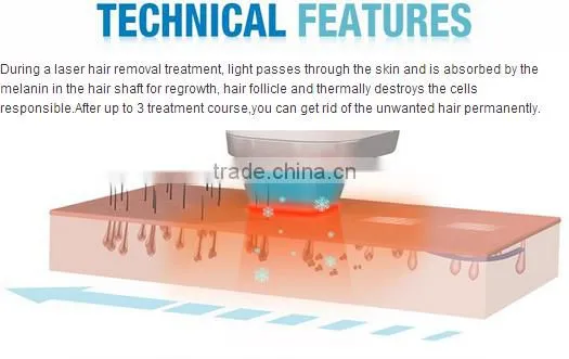 Painless 808nm portable diode laser hair removal machine for home use