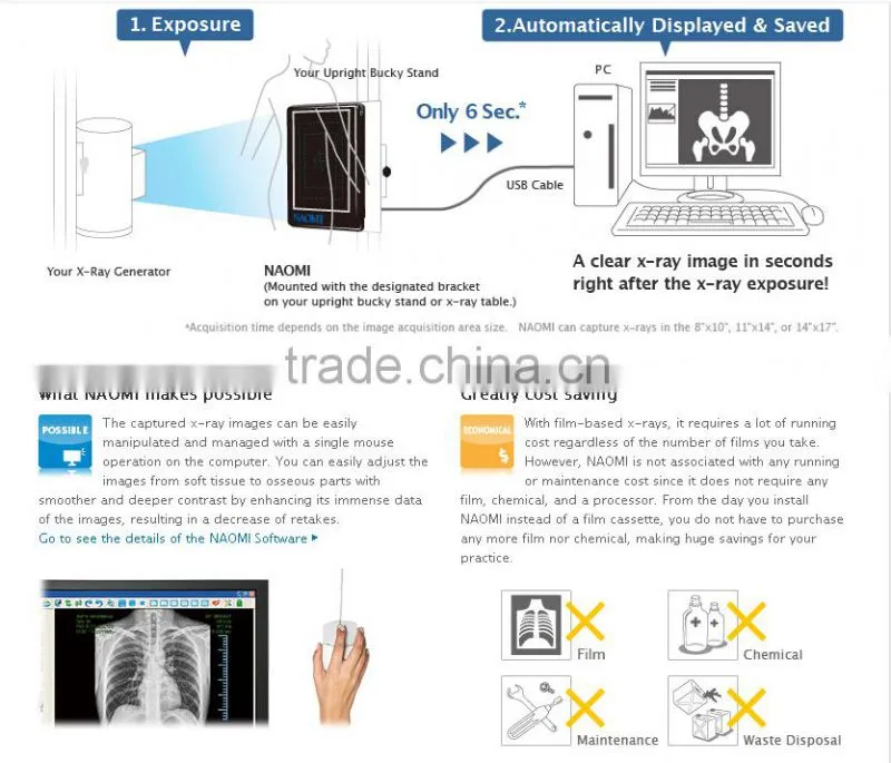 Direct Digital Radiography System