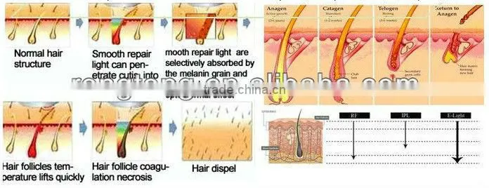 used portable bar hot & cold massager hair device
