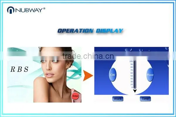 Spider Vein Removal / Blood Vessels Removal / Skin Tag Removal Machine
