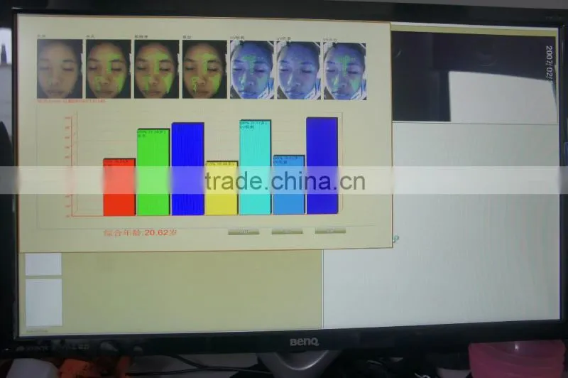 Smart system skin magnifying lamp analyzer skin test facial skin analyzer for clinic use