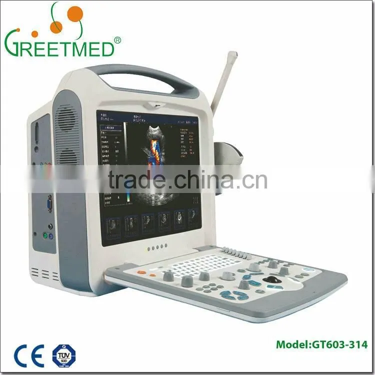 High quality new design cheap ultrasound machine