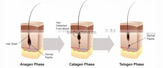 Portable Laser Diode Hair Loss Cure Therapy For Hair Growth Preventing Hair Loss