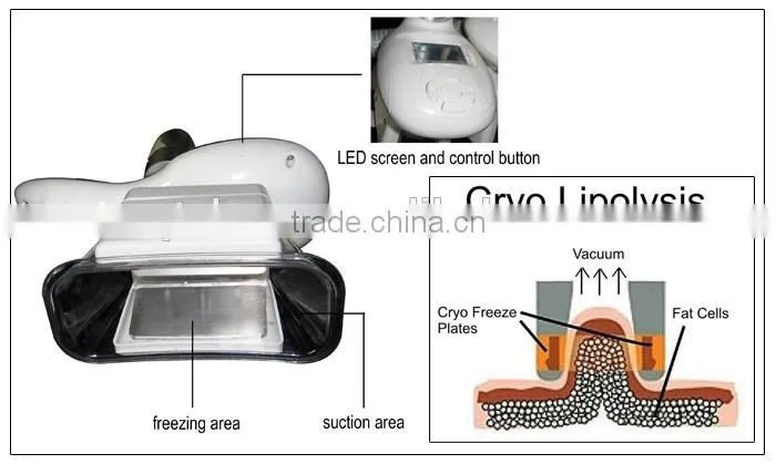 All body parts weight loss cryotherapy fat freezing fat loss machines