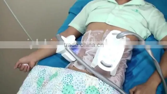 New Technology Acoustic Wave Therapy Cooling Fat Loss Machine