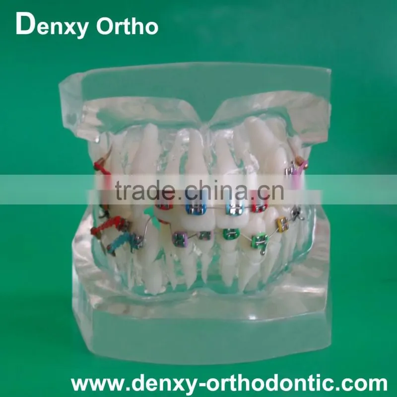 differnt types OEM dental orthodontic study model
