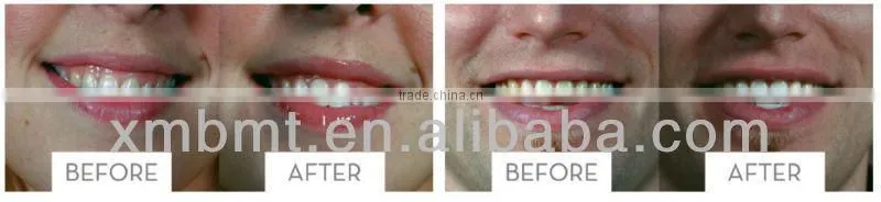 Teeth Remineralization Strips