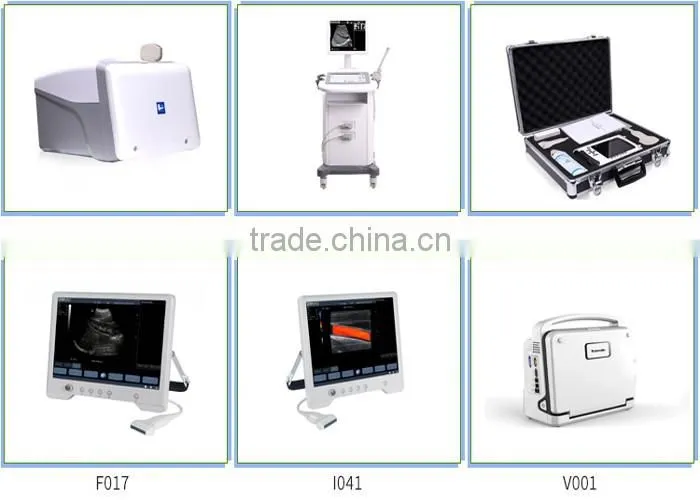 Vet Ultrasound/Veterinary Products/ Diagnostic Equipment for Animal