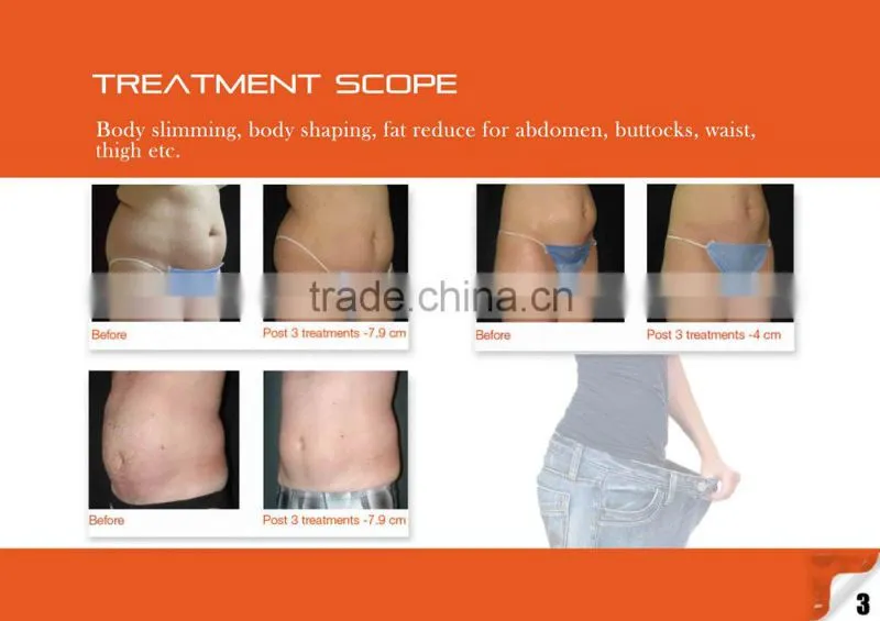 Fat Cavitation Device For Home/vacuum rf slimming/rf--pro Cryolipo