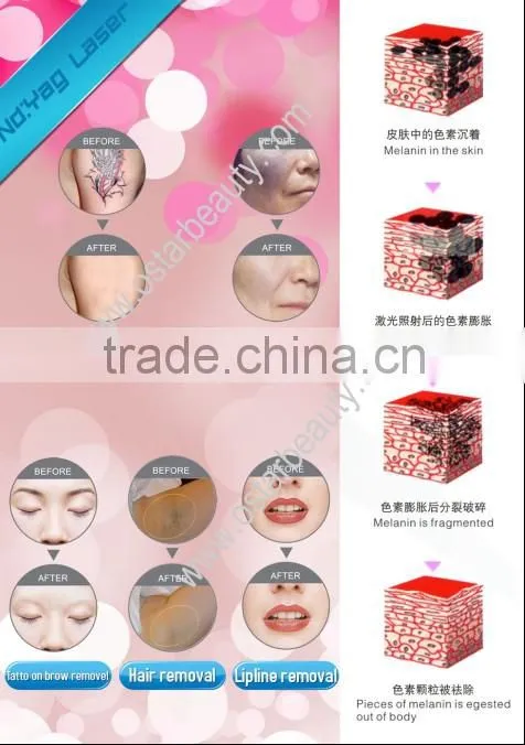 Professional elight laser beauty machine OB-NE 02