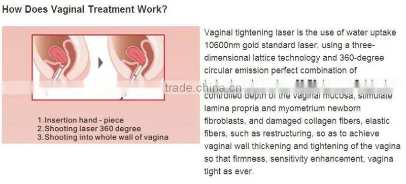 Professional Co2 for Skin Resurfacing Acne Scar Treatment