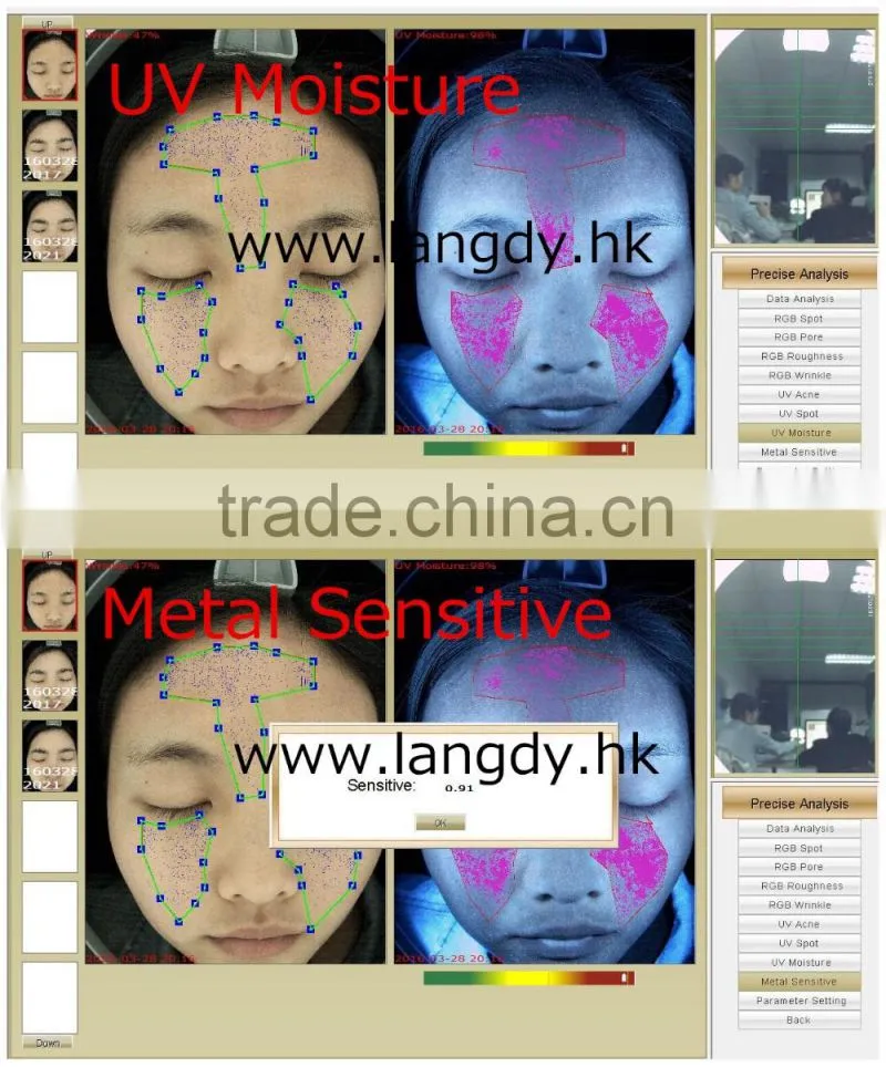 computer software skin analysis system acne wrinkle spot pore analyzer device