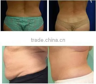 Home use Cavitation fat burning RF laser slimming machine