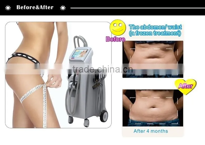Cryo fat reduction Lipo Laser body slimming machine