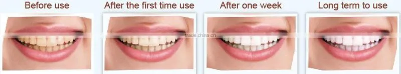 dental unit bulk buy melamine sponge France teeth whitening from china