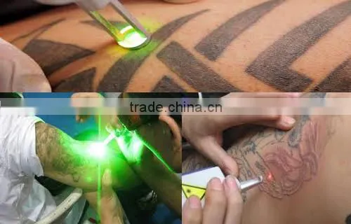 Fast selling !Tattoo machine for nd yag laser price tattoo removal laser