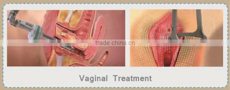 Popular model F7+ Beauty Device fractional co2 laser vaginal tightening