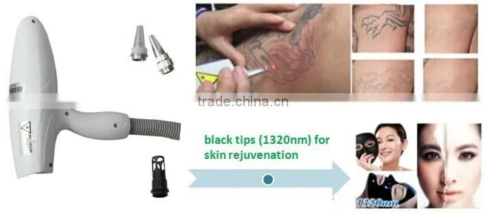 Good Body Care Equipment Tattoo Removal Q Switched Nd Yag Laser