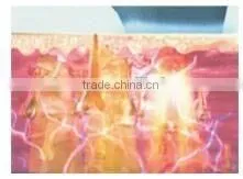 Painless vertical elight Hair Removal Equipment and skin rejuvenation machine