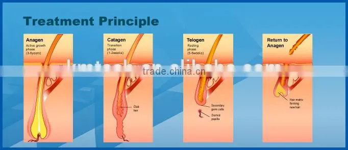 Cheap and Beautiful elight ipl rf for skin rejuvernation