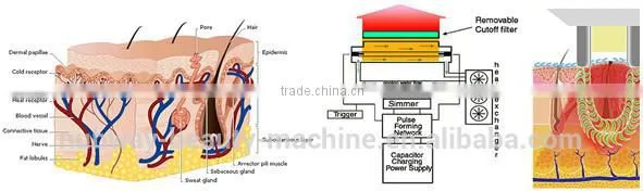 Promotion IPL !!! Hair Removal Photo Rejuvenation IPL Laser Machine Price