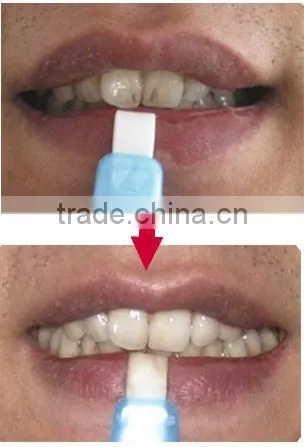 GTO teeth whitening kit