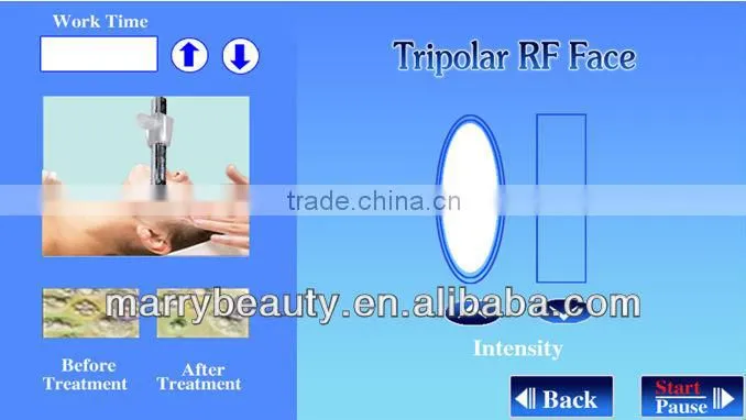 New Product Tripolar RF 40K Cavitation Machine