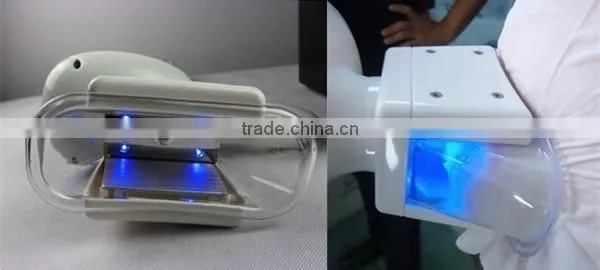 Portable double cryo handles vaccumm cryolipolysis Machine