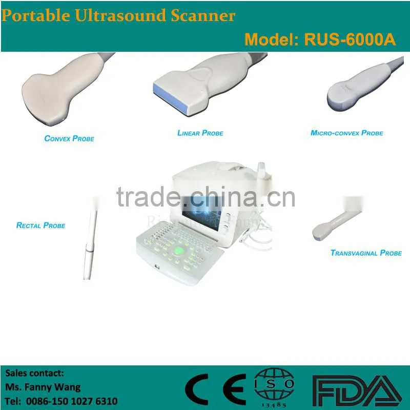CE approved Portable B-Mode Ultrasound Scanner with 3.5Mhz multi-frequency convex probe RUS-6000A