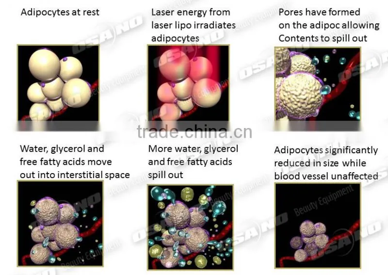 Cavitation rf weight loss machine cavitation rf and vacuum machine ultrasonic rf cavitation slimming machine