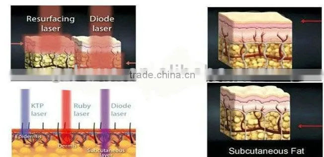 NO.1 2013-2017 10 paddles !!!popular 650nm laser, beauty equipoise ( Amazing Result at Fat loss!!!!!!!!!)