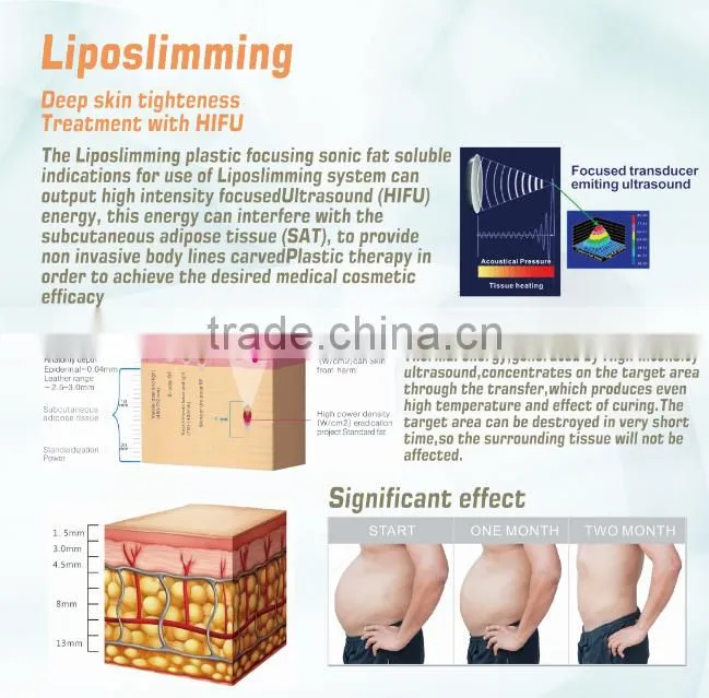New Face 2016 NV-S7B portable slimming machine liposonix slimming machine for weight lost