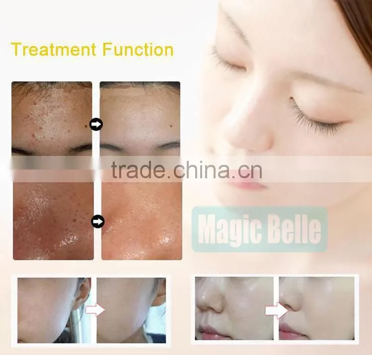 The factory price portable hydrotherapy machine face washing massage Hydro dermabrasion for salon use