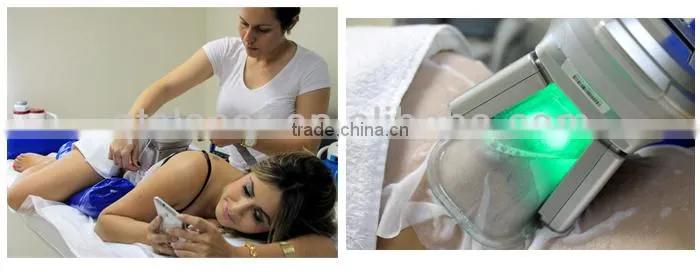 weight loss cavitation cryo lipo laser/criolipolisis fat freezing machine/cryo