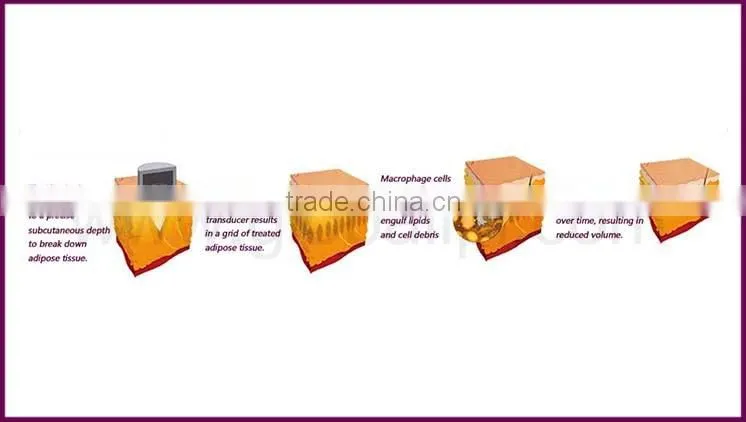 Alibaba china fat burning ultrasound machine made in China