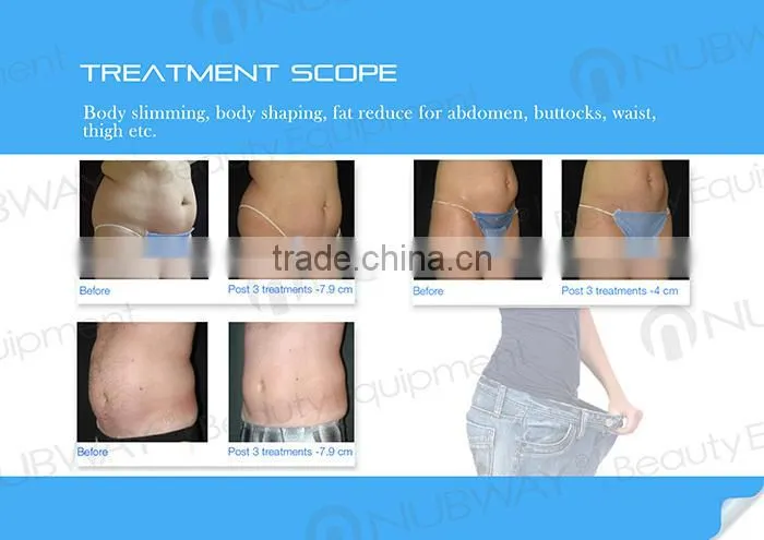 HIFU Slimming Machine disrupts localized fat deposits