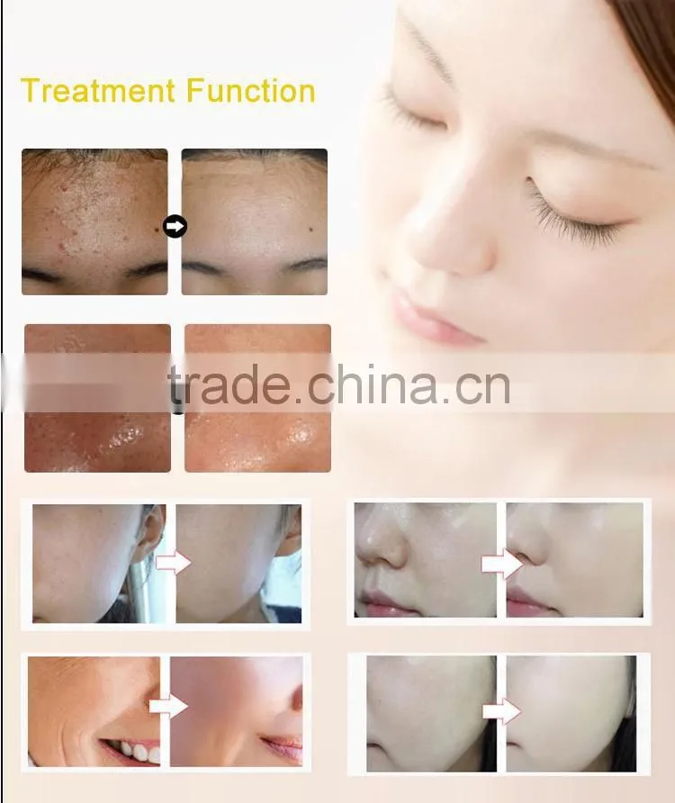 LED Mask!! 3 Colors LED Facial Mask PDT Machine with Teaching Video